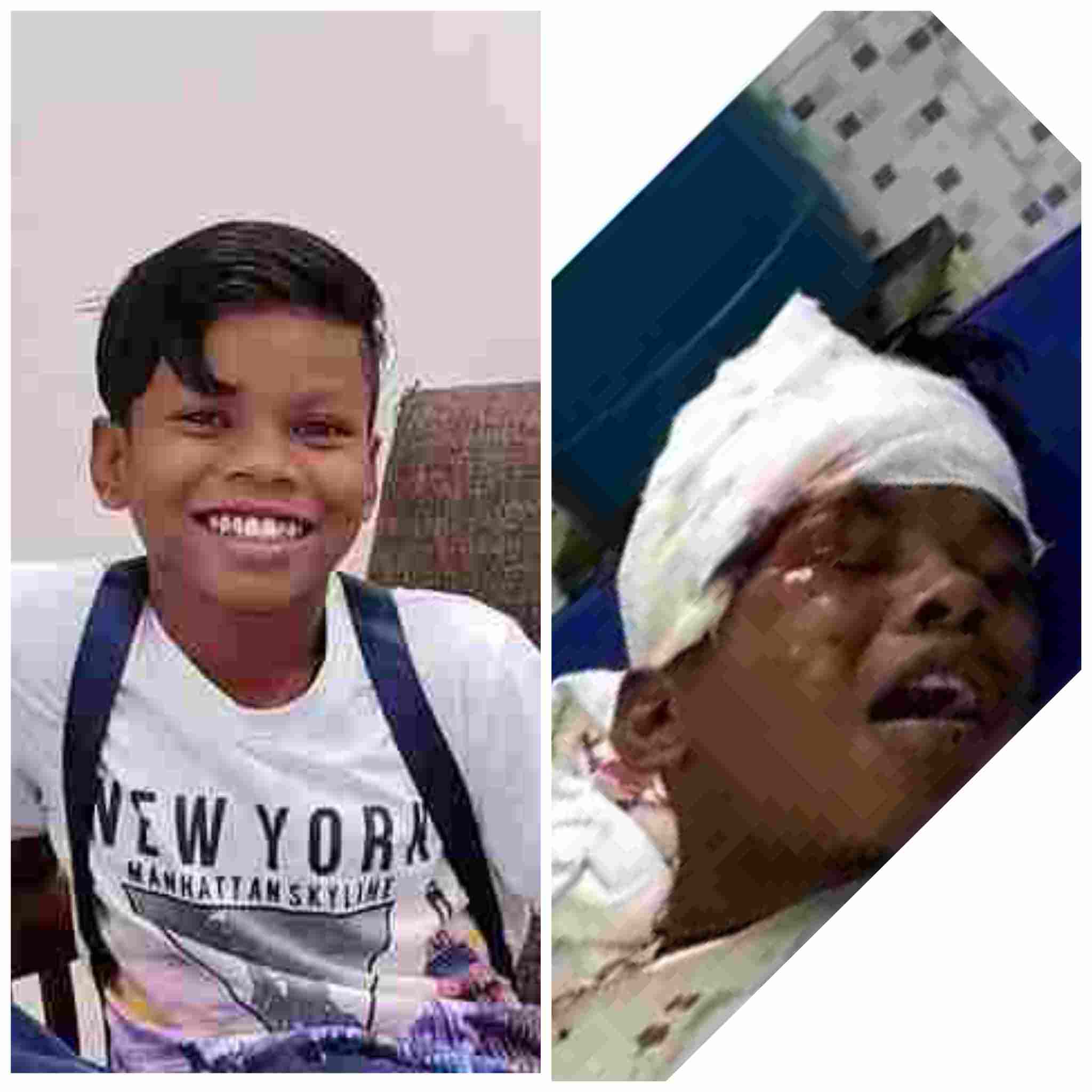 ब्रेकिंग न्यूज-बसपन का प्यार से पापुलर सहदेव दिरदो सड़क दुर्घटना में गंम्भीर रूप से घायल अस्पताल में चल रहा है इलाज