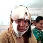 कमरे में बंद कर पत्नी पर चलाया चाकू पति ने , पीड़िता अस्पताल में भर्ती , मानिकपुर पुलिस कर रही जांच