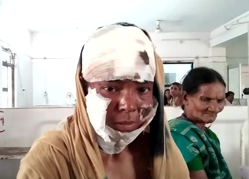 कमरे में बंद कर पत्नी पर चलाया चाकू पति ने , पीड़िता अस्पताल में भर्ती , मानिकपुर पुलिस कर रही जांच