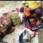 रायगढ़: अग्रसेन महोत्सव की साज सज्जा के दौरान हाइड्रोजन सिलेंडर फटा 2 जख्मी, कलेक्टर ने दिए जांच के आदेश