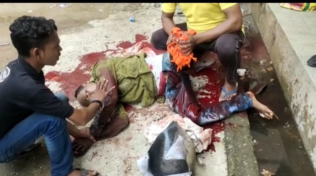 रायगढ़: अग्रसेन महोत्सव की साज सज्जा के दौरान हाइड्रोजन सिलेंडर फटा 2 जख्मी, कलेक्टर ने दिए जांच के आदेश