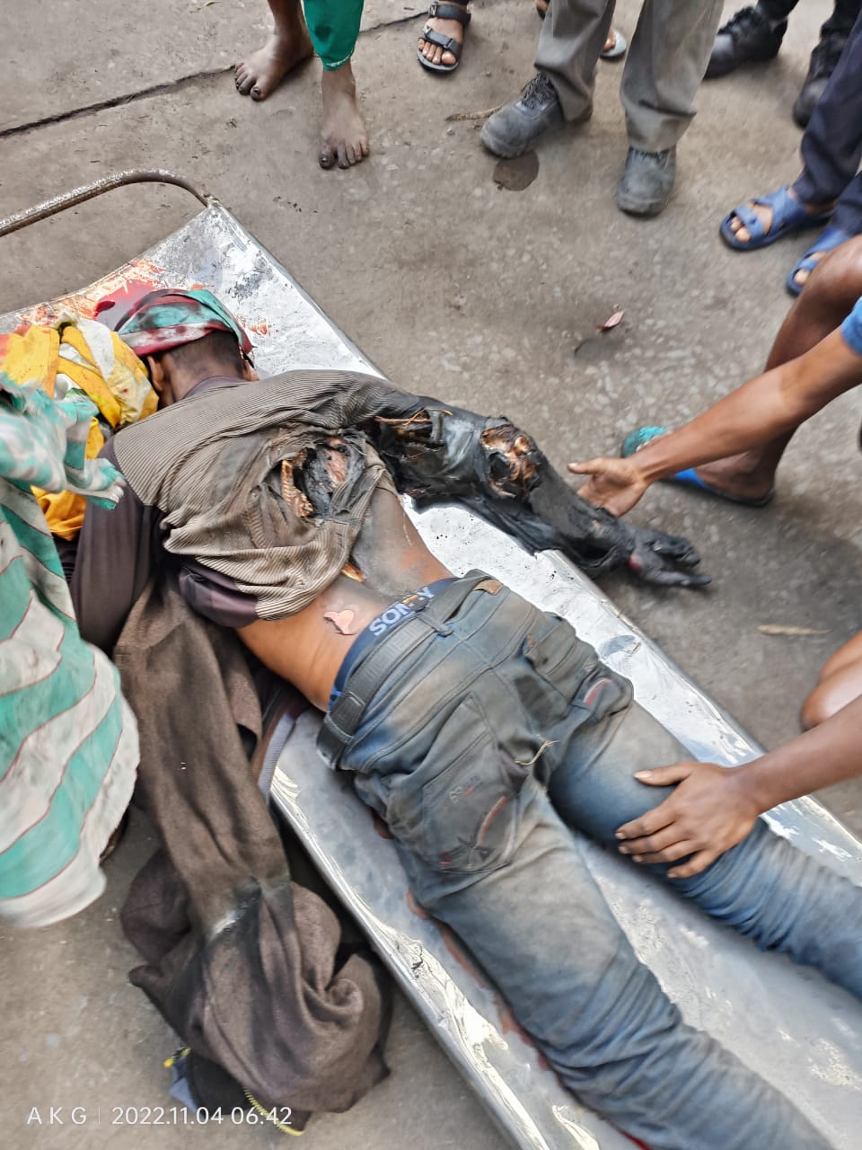 ब्रेकिंग न्यूज: गेरवानी के मां काली एलायंस में हादसा एक युवक कन्वेयर बेल्ट में फसकर मरा