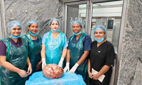 सिम्स अस्पताल के महिला डाक्टरों की टीम ने सफल ऑपरेशन कर  महिला के पेट से 10 किग्रा.से ज्यादा वजन का ट्यूमर निकाला